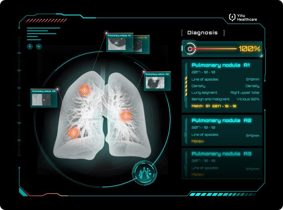 care.aiTM胸部CT智能四維影像系統                                    
