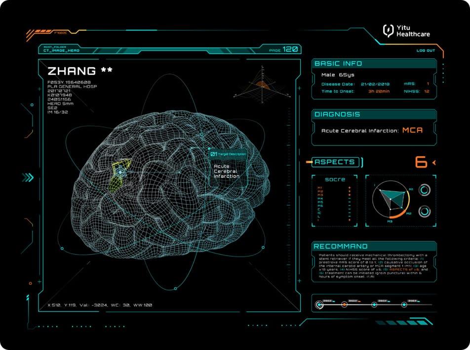 care.aiTM 卒中多學科智能決策支持系統